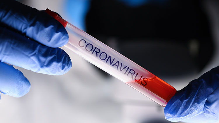 Fujifilm announces the start of a phase III clinical trial of influenza antiviral drug “Avigan Tablet” on COVID-19 and commits to increasing production.